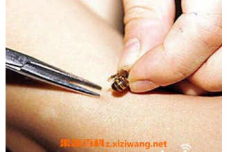 被蜂蜇了怎么办 被蜜蜂蛰了怎么处理