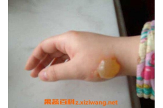 �������˺���ô���� �����˺�Ĵ�������